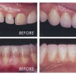craniofacial surgery nashik